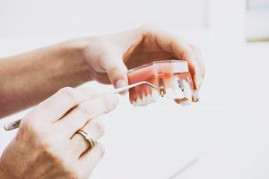 What are Dental Implants?