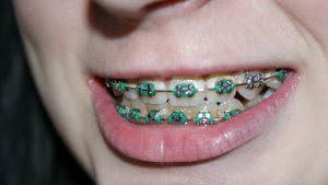 Oral Health Tips by Age Group