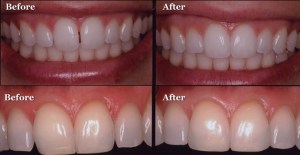 Before and after photos
