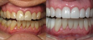 Benefits of Cosmetic Dentistry in Del Mar