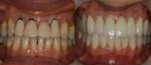 Before and after photos