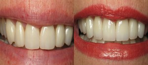 Before and after photos